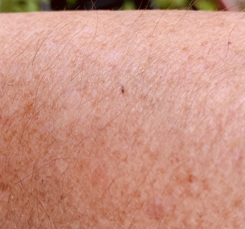 no-see-um biting bug